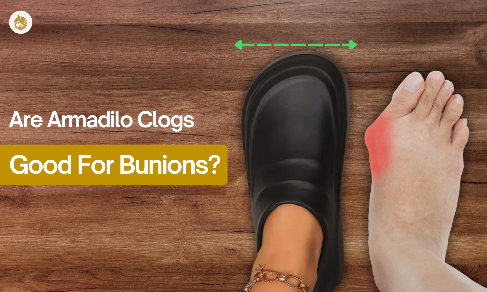 Are Armadilo Clogs Good for Bunions?